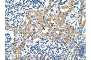 GPT antibody was used for immunohistochemistry at a concentration of 4-8 ug/ml to stain Epithelial cells of renal tubule (arrows) in Human Kidney. (ALT Antikörper)