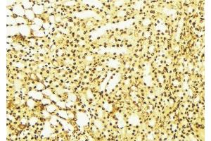 ABIN6275841 at 1/100 staining Mouse liver tissue by IHC-P. (DRAK2 Antikörper  (C-Term))