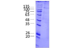 Mitogen-Activated Protein Kinase Kinase Kinase 14 (AA 1-947), gel filtration Superose 6, fraction 7-9 (MAP3K14 Protein (AA 1-947) (Strep Tag))