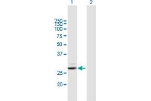 Western Blot analysis of PRSS2 expression in transfected 293T cell line by PRSS2 MaxPab polyclonal antibody. (PRSS2 Antikörper  (AA 1-239))