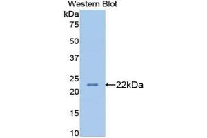 Detection of Recombinant APOB, Rat using Monoclonal Antibody to Apolipoprotein B (APOB) (APOB Antikörper  (AA 2747-2913))