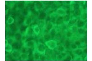 Immunofluorescence (IF) image for anti-Caspase 12 (Gene/pseudogene) (CASP12) (AA 95-318), (N-Term) antibody (ABIN567795) (Caspase 12 Antikörper  (N-Term))