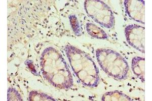 Immunohistochemistry of paraffin-embedded human colon tissue using ABIN7143353 at dilution of 1:100
