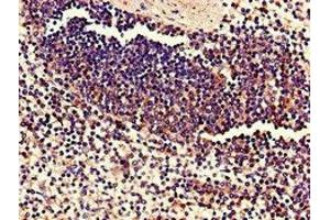Immunohistochemistry of paraffin-embedded human spleen tissue using ABIN7174759 at dilution of 1:100 (C17orf78 Antikörper  (AA 1-186))