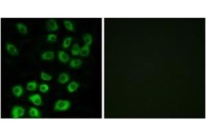 Immunofluorescence analysis of MCF7 cells, using ARFGAP1 Antibody. (ARFGAP1 Antikörper  (AA 171-220))