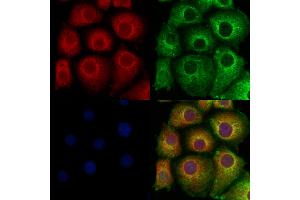 ABIN6260109 and ABIN6278114 staining Hela cells by IF/ICC. (ATG9A Antikörper  (Internal Region))