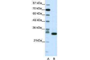 WB Suggested Anti-CDK5 Antibody Titration:  1. (CDK5 Antikörper  (N-Term))