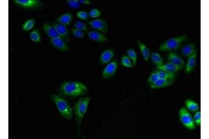 Immunofluorescent analysis of HepG2 cells using ABIN7143514 at dilution of 1:100 and Alexa Fluor 488-congugated AffiniPure Goat Anti-Rabbit IgG(H+L) (ARL6IP1 Antikörper  (AA 93-133))