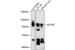 Western blot analysis of extracts of various cell lines, using  antibody (ABIN6130862, ABIN6136444, ABIN6136445 and ABIN6216549) at 1:3000 dilution. (Acox2 Antikörper  (AA 1-150))