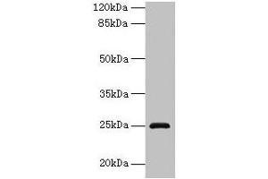 Western blot All lanes: RAB32 antibody at 3 μg/mL + Mouse kidney tissue Secondary Goat polyclonal to rabbit IgG at 1/10000 dilution Predicted band size: 25 kDa Observed band size: 25 kDa (RAB32 Antikörper  (AA 2-225))