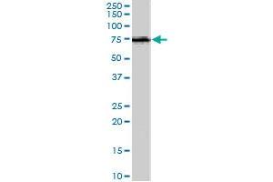ACSL5 polyclonal antibody  (1 ug/mL) staining of human spleen lysate (35 ug protein in RIPA buffer). (ACSL5 Antikörper)