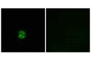 Immunofluorescence analysis of A549 cells, using CHST6 antibody. (CHST6 Antikörper)