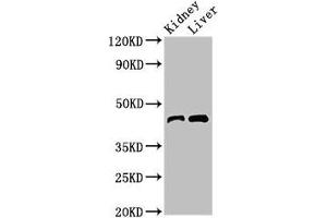 Western Blot Positive WB detected in: Mouse kidney tissue, Mouse liver tissue All lanes: BLZF1 antibody at 3 μg/mL Secondary Goat polyclonal to rabbit IgG at 1/50000 dilution Predicted band size: 45, 20 kDa Observed band size: 45 kDa (BLZF1 Antikörper  (AA 11-99))