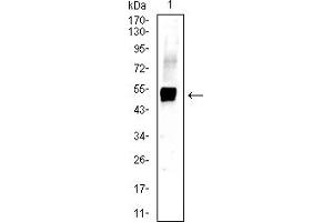 Western blot analysis using KRT13 mouse mAb against A431 (1) cell lysate. (Cytokeratin 13 Antikörper  (AA 104-458))