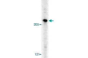 Western blot analysis of CASP8AP2 in HeLa whole cell lysates with CASP8AP2 polyclonal antibody  at 0.