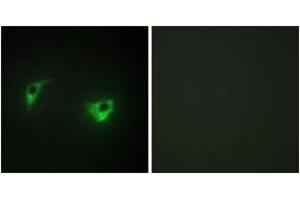 Immunofluorescence analysis of A549 cells, using MEKKK 4 Antibody. (MAP4K4 Antikörper  (AA 406-455))