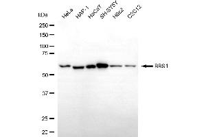 anti-Bardet-Biedl Syndrome 1 (BBS1) antibody
