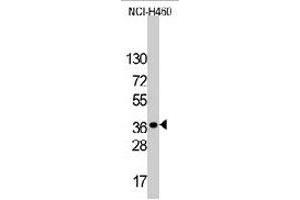 Western blot analysis of LDLRAP1 polyclonal antibody  in NCI-H460 cell line lysates (35 ug/lane). (LDLRAP1 Antikörper  (C-Term))