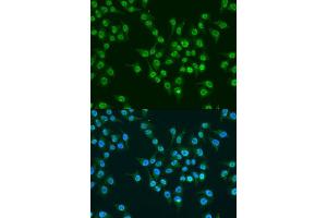 Immunofluorescence (IF) image for anti-Kruppel-Like Factor 4 (Gut) (KLF4) (AA 180-479) antibody (ABIN6142920)