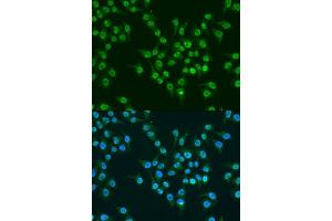 Immunofluorescence analysis of U2OS cells using KLF4 antibody. (KLF4 Antikörper  (AA 180-479))
