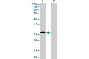Western Blot analysis of IGSF6 expression in transfected 293T cell line by IGSF6 MaxPab polyclonal antibody. (IGSF6 Antikörper  (AA 1-241))