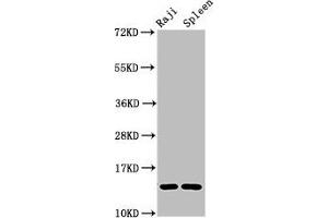 Western Blot Positive WB detected in: Raji whole cell lysate, Rat spleen tissue All lanes: GABARAPL2 antibody at 4 μg/mL Secondary Goat polyclonal to rabbit IgG at 1/50000 dilution Predicted band size: 14 kDa Observed band size: 14 kDa (GABARAPL2 Antikörper  (AA 1-117))