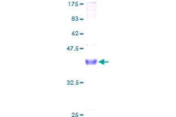 Neuregulin 4 Protein (NRG4) (AA 1-115) (GST tag)