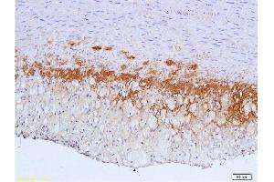 Formalin-fixed and paraffin embedded: rabbit carotid artery labeled with Anti-TGF-beta-R2/TGFBR2 Polyclonal Antibody , Unconjugated 1:600 followed by conjugation to the secondary antibody and DAB staining