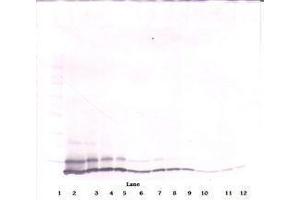 Image no. 3 for anti-Chemokine (C-X-C Motif) Ligand 1 (Melanoma Growth Stimulating Activity, Alpha) (CXCL1) antibody (ABIN465460) (CXCL1 Antikörper)