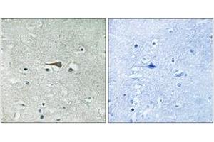 Immunohistochemistry analysis of paraffin-embedded human brain tissue, using TTK (Ab-676) Antibody. (Mps1 Antikörper  (AA 642-691))
