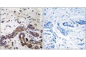 Immunohistochemistry analysis of paraffin-embedded human testis tissue, using CLASP1 Antibody. (CLASP1 Antikörper  (AA 1171-1220))