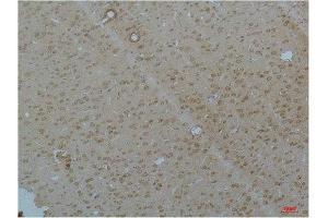 Immunohistochemistry (IHC) analysis of paraffin-embedded Rat Brain Tissue using Cav pan alpha1Rabbit Polyclonal Antibody diluted at 1:200. (Cav Pan Alpha1 (pan) Antikörper)