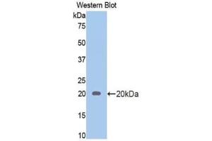 Western blot analysis of the recombinant protein. (Androgen Receptor Antikörper  (AA 765-902))