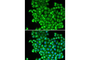 Immunofluorescence analysis of A549 cells using LDHA antibody (ABIN5970494). (Lactate Dehydrogenase A Antikörper)