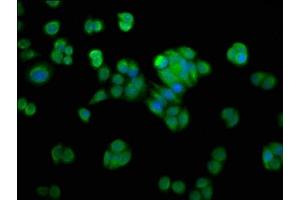 Immunofluorescence staining of PC-3 cells with ABIN7161661 at 1:200, counter-stained with DAPI. (NMRAL1 Antikörper  (AA 1-299))