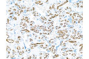 Immunohistochemistry (IHC) image for anti-CD34 (CD34) (AA 33-290) antibody (ABIN7453960)