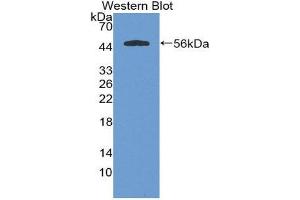 Western Blotting (WB) image for anti-Cystatin SA (CST2) (AA 21-141) antibody (ABIN3201796) (CST2 Antikörper  (AA 21-141))