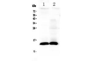 Western blot analysis of TFF2 using anti-TFF2 antibody . (Trefoil Factor 2 Antikörper  (AA 24-129))