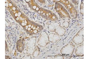 Immunoperoxidase of monoclonal antibody to CDC42BPB on formalin-fixed paraffin-embedded human small Intestine.