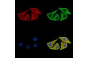 ABIN7096606 and ABIN7100670 staining Hela cells by IF/ICC. (TBC1D24 Antikörper)