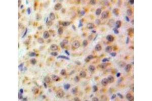 IHC-P analysis of Ovary tissue, with DAB staining. (NUP50 Antikörper  (AA 134-393))