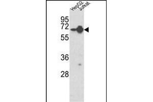 Western blot analysis of HNRPL Antibody (Center) (ABIN650774 and ABIN2839554) in HepG2, Jurkat cell line lysates (35 μg/lane). (HNRNPL Antikörper  (AA 249-277))