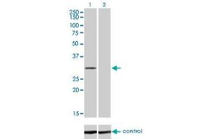 Western blot analysis of COASY over-expressed 293 cell line, cotransfected with COASY Validated Chimera RNAi (Lane 2) or non-transfected control (Lane 1). (COASY Antikörper  (AA 1-225))