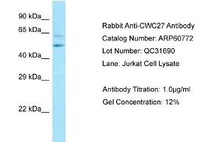 Western Blotting (WB) image for anti-CWC27 Spliceosome-Associated Protein Homolog (Cwc27) (C-Term) antibody (ABIN2788570) (Cwc27 Antikörper  (C-Term))