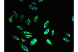 Immunofluorescence staining of Hela cells with ABIN7145178 at 1:400, counter-stained with DAPI. (BCAP31 Antikörper  (AA 2-243))