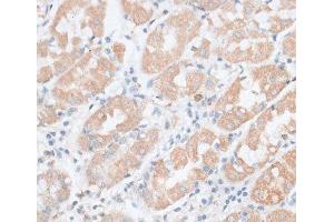 Immunohistochemistry of paraffin-embedded Human stomach using PAEP Polyclonal Antibody at dilution of 1:100 (40x lens). (PAEP Antikörper)