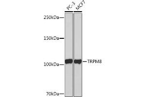 Western blot analysis of extracts of various cell lines, using TRPM8 Rabbit mAb (ABIN1678662, ABIN3018757, ABIN3018758 and ABIN7101657) at 1:1000 dilution. (TRPM8 Antikörper)