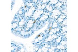 Immunohistochemistry of paraffin embedded mouse colon using IL34 (ABIN7074359) at dilution of 1:900 (400x lens) (IL-34 Antikörper)