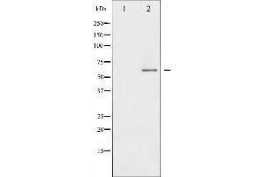 Western blot analysis of IL-10R alpha phosphorylation expression in HuvEc whole cell lysates,The lane on the left is treated with the antigen-specific peptide. (IL-10RA Antikörper  (pTyr496))