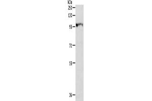 Gel: 8 % SDS-PAGE, Lysate: 40 μg, Lane: Human fetal liver tissue, Primary antibody: ABIN7130225(MGEA5 Antibody) at dilution 1/300, Secondary antibody: Goat anti rabbit IgG at 1/8000 dilution, Exposure time: 30 seconds